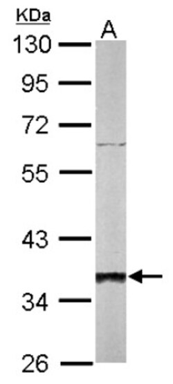 SGTA Antibody, Novus Biologicals 0.1mg; Unlabeled:Antibodies, Polyclonal