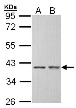SGTA Antibody, Novus Biologicals 0.1mg; Unlabeled:Antibodies, Polyclonal