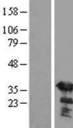 Novus Biologicals&trade;&nbsp;SGTA Overexpression Lysate