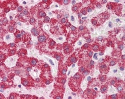 SH2B1 Antibody, Novus Biologicals 0.05mg; Unlabeled:Antibodies, Polyclonal