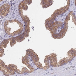 SH2B2 Antibody, Novus Biologicals 0.1mL; Unlabeled:Antibodies, Polyclonal