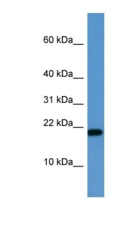SH2D1A Antibody, Novus Biologicals 100&mu;L; Unlabeled:Antibodies, Polyclonal