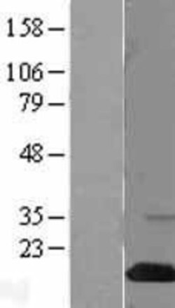 Novus Biologicals&trade;&nbsp;SH2D1A Overexpression Lysate