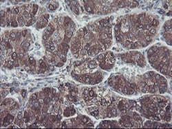 SH2D2A Antibody (OTI4F3), Novus Biologicals 0.1mL; Unlabeled:Antibodies,
