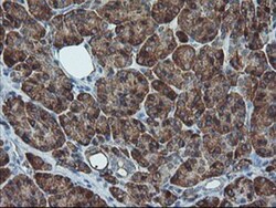 SH2D2A Antibody (OTI4F3), Novus Biologicals 0.1mL; Unlabeled:Antibodies,