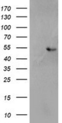 SH2D2A Antibody (OTI4F3), Novus Biologicals 0.1mL; Unlabeled:Antibodies,