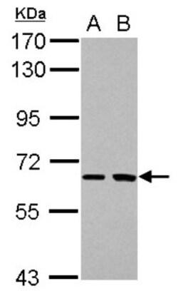 SH2D3A Antibody, Novus Biologicals 0.1mL; Unlabeled:Antibodies, Polyclonal