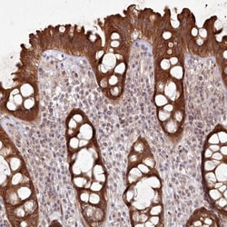 SH2D3A Antibody, Novus Biologicals 0.1mL; Unlabeled:Antibodies, Polyclonal