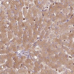 SH2D6 Antibody, Novus Biologicals 25 &mu;L, Unlabeled:Antibodies, Polyclonal