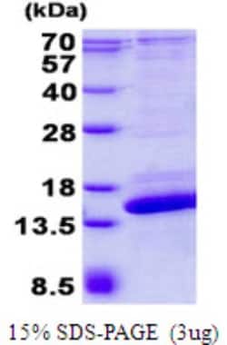 Novus Biologicals&trade;&nbsp;Recombinant Human SH3BGRL2 His Protein
