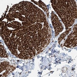 SH3BGRL3 Antibody, Novus Biologicals:Antibodies:Primary Antibodies