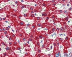 SH3BP2 Antibody, Novus Biologicals 0.05mg; Unlabeled:Antibodies, Polyclonal