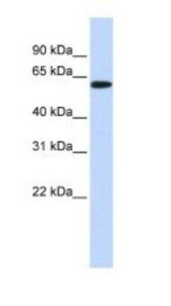 SH3BP2 Antibody, Novus Biologicals 0.05mg; Unlabeled:Antibodies, Polyclonal
