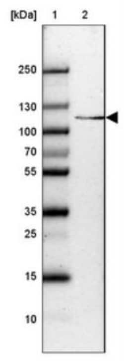 SH3BP4 Antibody, Novus Biologicals 0.1mL; Unlabeled:Antibodies, Polyclonal