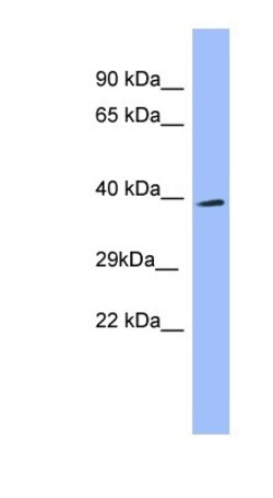 Endophilin A1/SH3GL2 Antibody, Novus Biologicals 100&mu;L; Unlabeled:Antibodies,