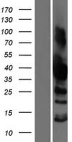 Novus Biologicals™ SH3GL3 Overexpression Lysate
