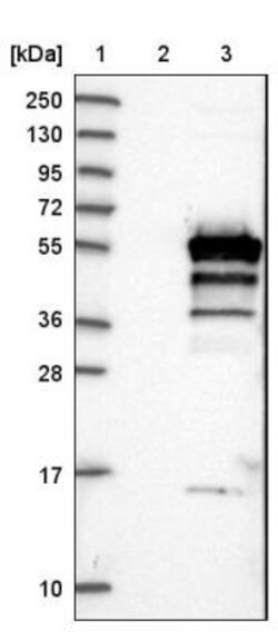 SH3GLB2 Antibody, Novus Biologicals:Antibodies:Primary Antibodies