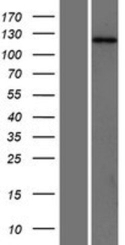Novus Biologicals&trade;&nbsp;SH3PXD2A Overexpression Lysate