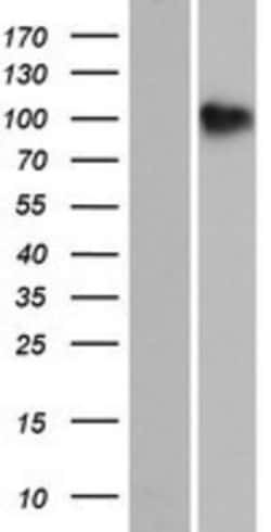Novus Biologicals&trade;&nbsp;SH3PXD2B Overexpression Lysate