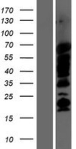 Novus Biologicals&trade;&nbsp;SHB Overexpression Lysate