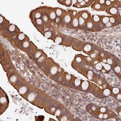 SHB Antibody, Novus Biologicals 0.1mL; Unlabeled:Antibodies, Polyclonal