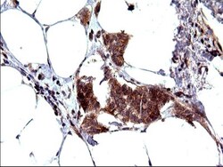 SHBG Antibody (OTI1H10), Novus Biologicals 0.1mL; Unlabeled:Antibodies,