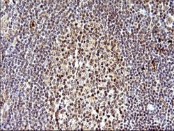 SHBG Antibody (OTI1H10), Novus Biologicals 0.1mL; Unlabeled:Antibodies,