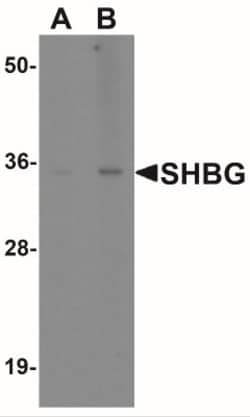 SHBG Antibody - BSA Free, Novus Biologicals:Antibodies:Primary Antibodies