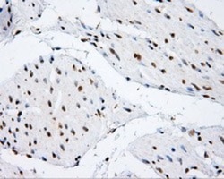 SHC1 Antibody (OTI3A1), Novus Biologicals 0.1mL; Unlabeled:Antibodies,