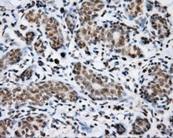 SHC1 Antibody (OTI3A1), Novus Biologicals 0.1mL; Unlabeled:Antibodies,