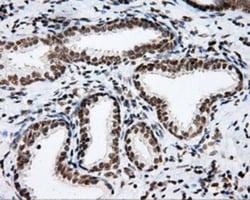 SHC1 Antibody (OTI3A1), Novus Biologicals 0.1mL; Unlabeled:Antibodies,