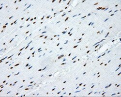 SHC1 Antibody (OTI3A1), Novus Biologicals 0.1mL; Unlabeled:Antibodies,