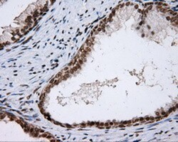 SHC1 Antibody (OTI3A1), Novus Biologicals 0.1mL; Unlabeled:Antibodies,