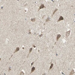 SHC2 Antibody, Novus Biologicals 0.1mL; Unlabeled:Antibodies, Polyclonal