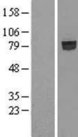 Novus Biologicals&trade;&nbsp;SHCBP1 Overexpression Lysate