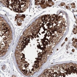 SHCBP1L Antibody, Novus Biologicals 0.1mL; Unlabeled:Antibodies, Polyclonal