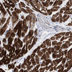 SHD Antibody, Novus Biologicals 0.1mL; Unlabeled:Antibodies, Polyclonal