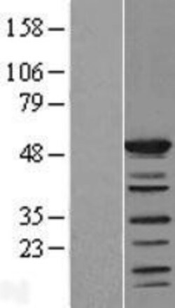 Novus Biologicals&trade;&nbsp;SHD Overexpression Lysate