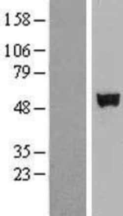 Novus Biologicals&trade;&nbsp;SHE Overexpression Lysate