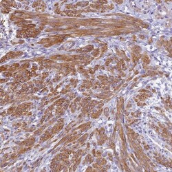 SHFM3 Antibody, Novus Biologicals 0.1mL; Unlabeled:Antibodies, Polyclonal