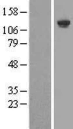 Novus Biologicals&trade;&nbsp;SHIP Overexpression Lysate