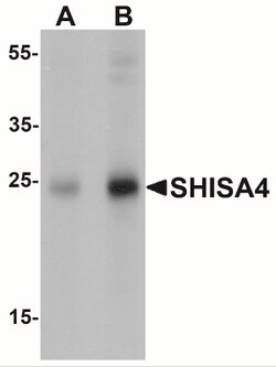 Shisa-4 Antibody - BSA Free, Novus Biologicals 0.05mg; Unlabeled:Antibodies,