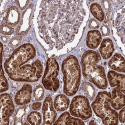 SHISA5 Antibody, Novus Biologicals 0.1mL; Unlabeled:Antibodies, Polyclonal