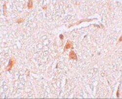 SHISA9 Antibody - BSA Free, Novus Biologicals 0.1 mg | Buy Online | Novus Biologicals | Fisher Scientific