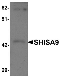 SHISA9 Antibody - BSA Free, Novus Biologicals 0.1 mg | Buy Online | Novus Biologicals | Fisher Scientific