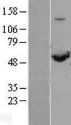 Novus Biologicals&trade;&nbsp;SHMT1 Overexpression Lysate
