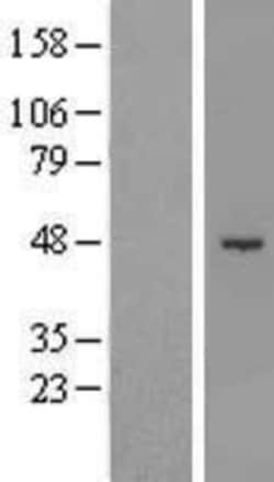 Novus Biologicals&trade;&nbsp;SHMT1 Overexpression Lysate