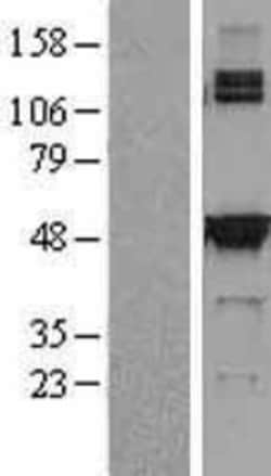Novus Biologicals&trade;&nbsp;SHMT2 Overexpression Lysate