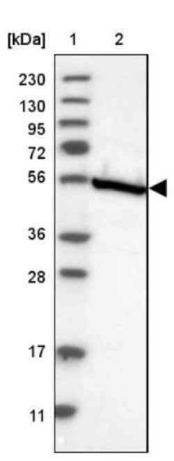 SHMT2 Antibody, Novus Biologicals 0.1mL; Unlabeled:Antibodies, Polyclonal