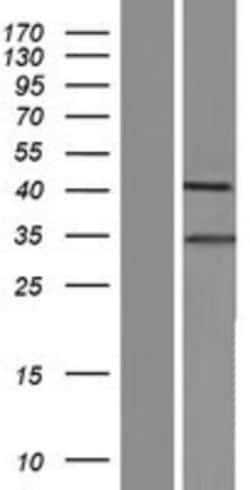 Novus Biologicals&trade;&nbsp;SHOX2 Overexpression Lysate